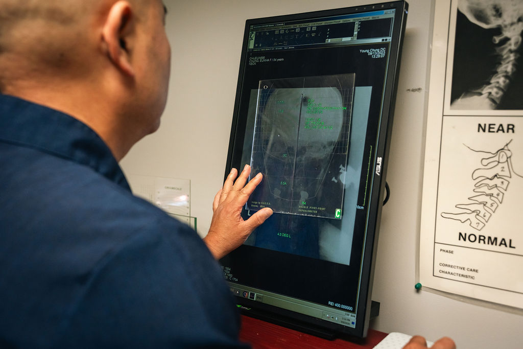 NUCCA_XRAYS_CHUNG_2026